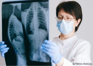 Tuberkuliozė: simptomai, eiga, prevencija bei situacija Lietuvoje