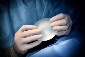 Krūtų implantų liga: kai noras būti gražesnei tampa pavojingas sveikatai