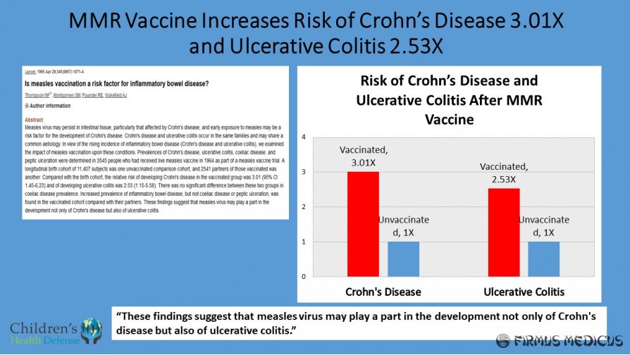 Krono ligos ir opinio kolito išsivystymo pavojus dėl MMR vakcinos